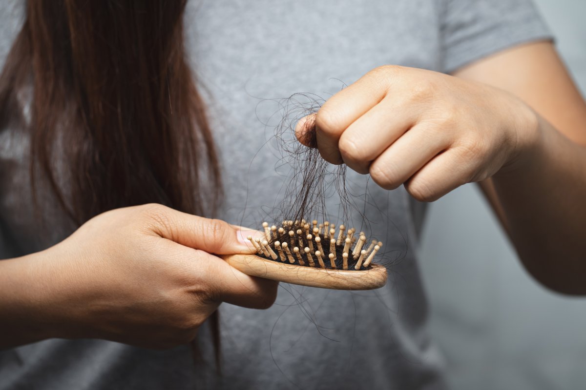 Chute de cheveux au fil des saisons